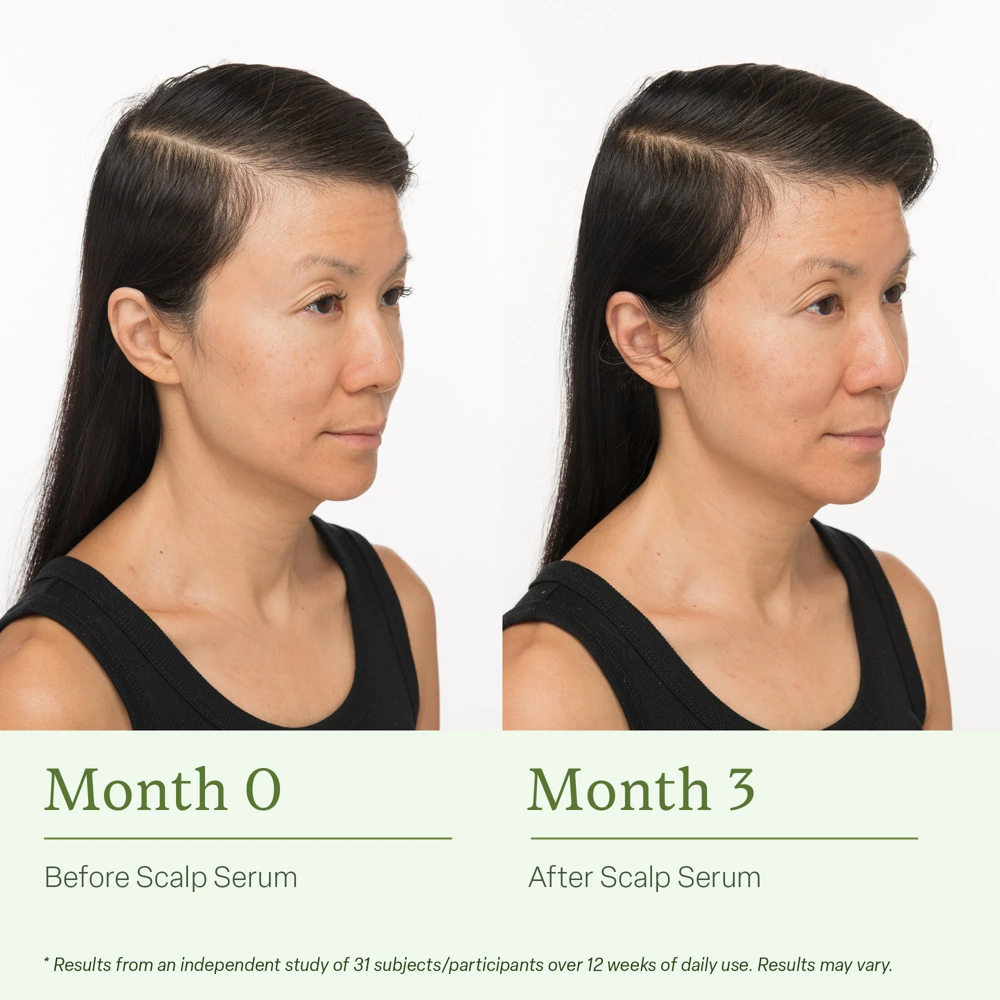 Scalp Serum   Travel-Sized Volume Duo