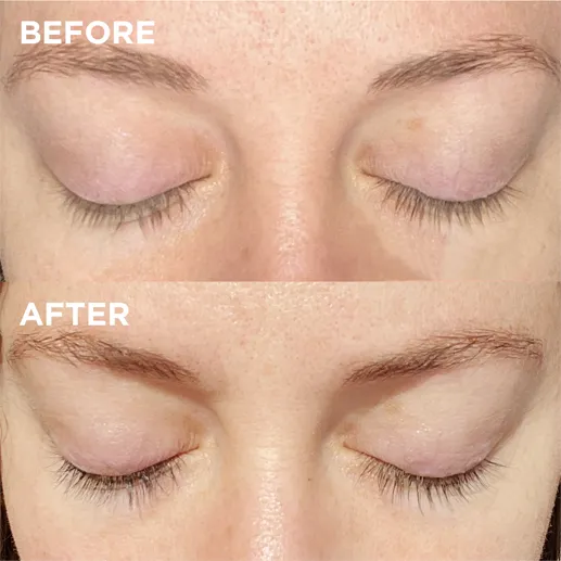 The Venus Lash™ Growth Serum